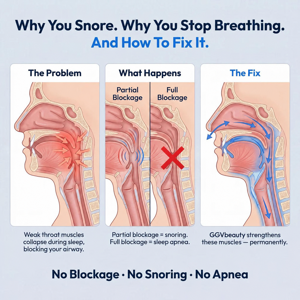 Eliminates Snoring & Sleep Apnea