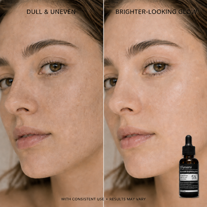 Elyssara 5% Niacinamide + Alpha Arbutin Dark Spot Serum