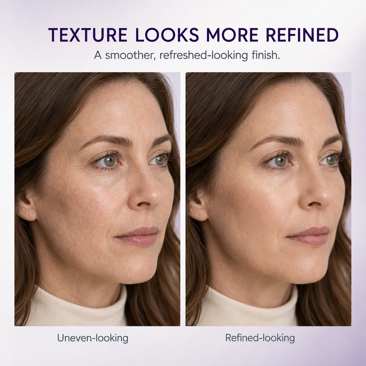 Vita A Retinal Volume Booster