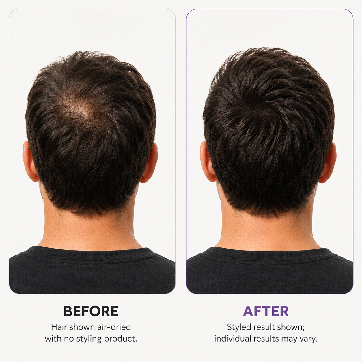 Scalp Revitalizing Solution Hair Thickening Roll On Serum
