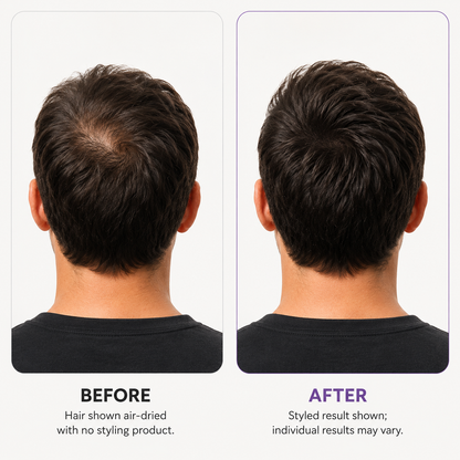 Scalp Revitalizing Solution Hair Thickening Roll On Serum