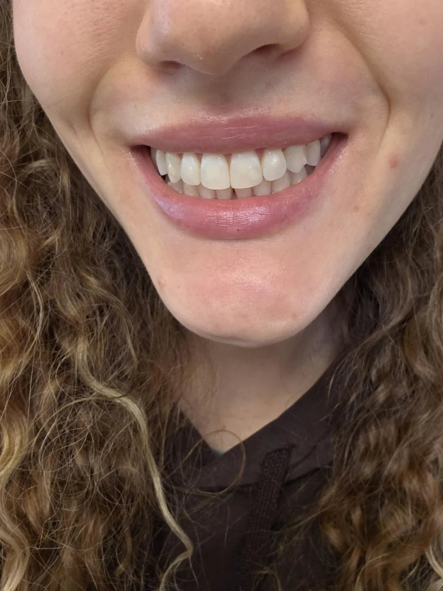 Placeholder image for an illustrative toothpaste review draft