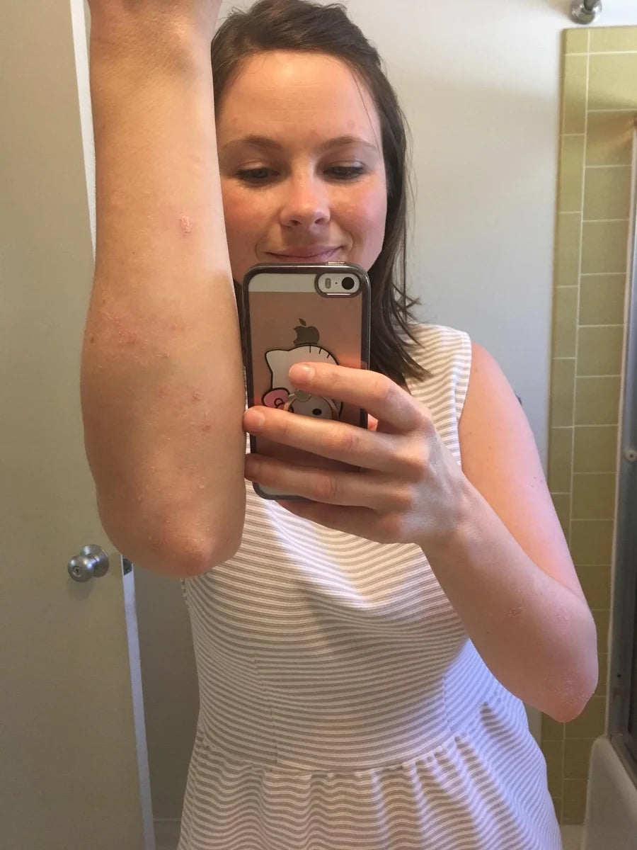 Placeholder portrait for an illustrative Elyssara skin-care review