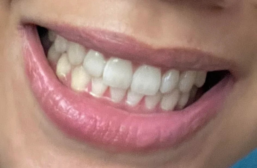Placeholder image for an illustrative toothpaste review draft