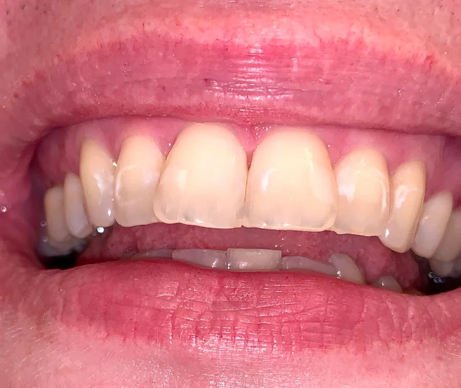 Placeholder image for an illustrative toothpaste review draft