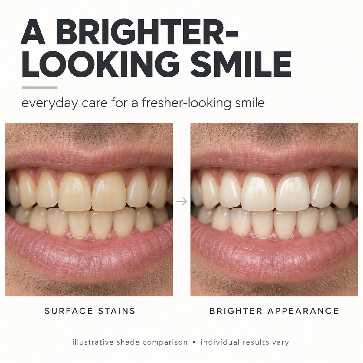 Nano (n-Ha) Toothpaste